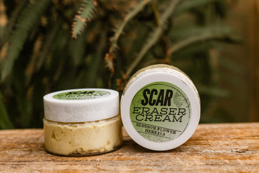 Scar Eraser All Natural Balm | Fade Scars & Promote Healthy Skin